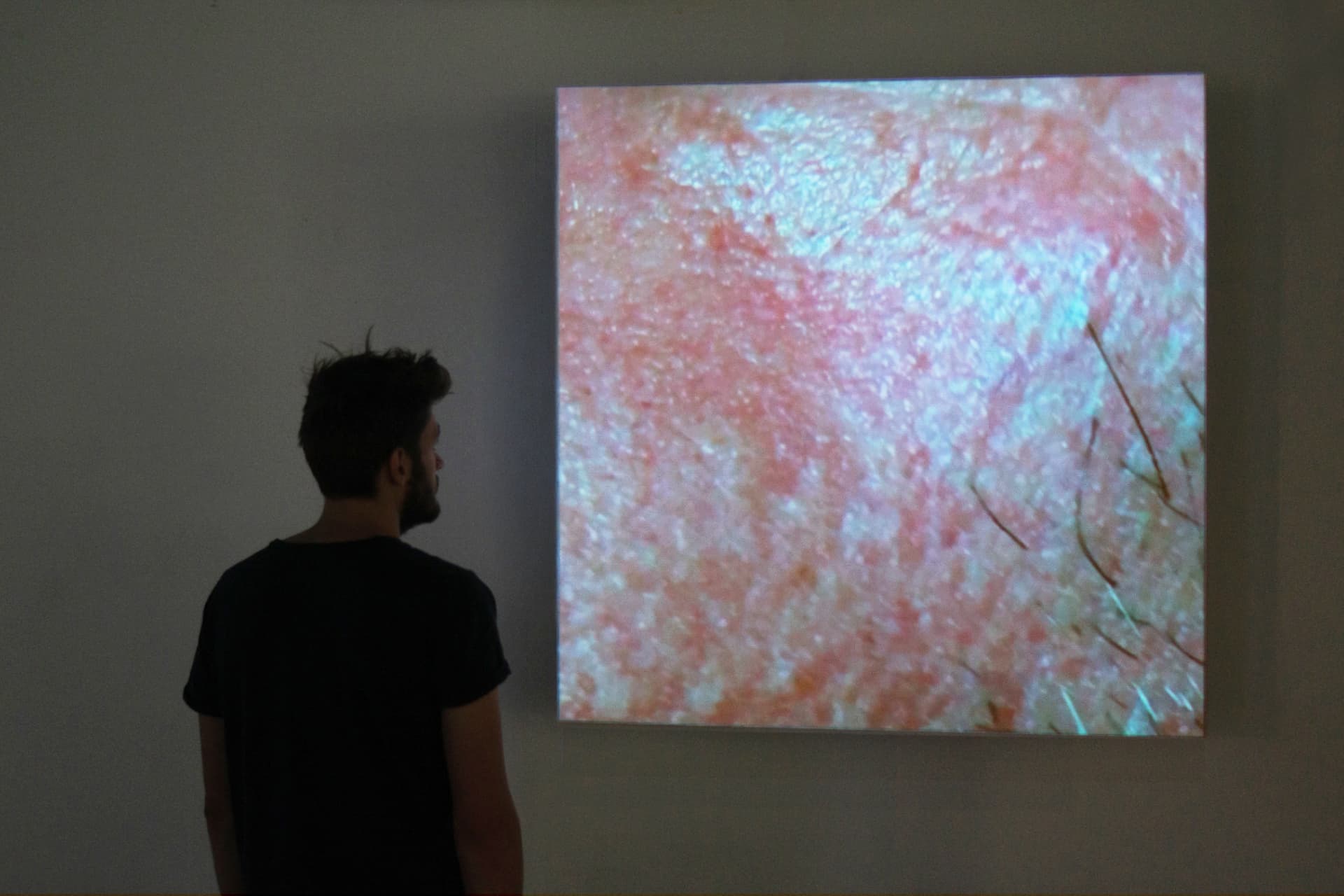 A man is standing in front of a projection showing a detailed macro image of skin.